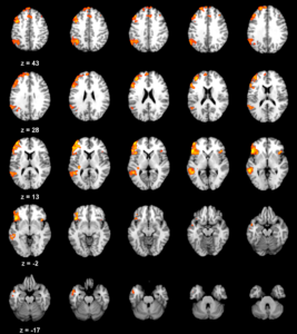 Maryam Ziaei: Emotion and aging brain @ Rådhussalen, Trondheim folkebibliotek